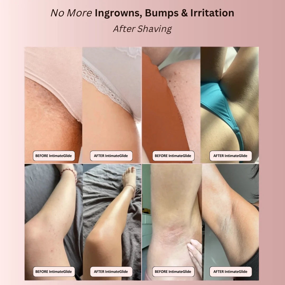 IntimateGlide™ Pro