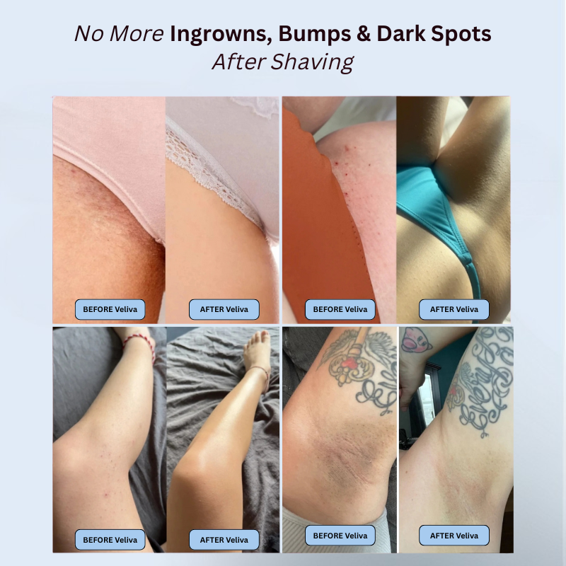 Smoothing Solution Roll-On